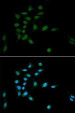 PSMA1 Antibody in Immunocytochemistry (ICC/IF)