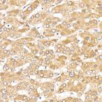 ACK1 Antibody in Immunohistochemistry (Paraffin) (IHC (P))