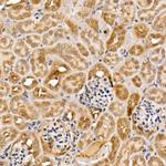 ACK1 Antibody in Immunohistochemistry (Paraffin) (IHC (P))