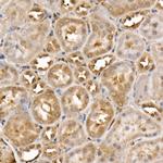 ACK1 Antibody in Immunohistochemistry (Paraffin) (IHC (P))