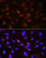 PLK1 Antibody in Immunocytochemistry (ICC/IF)