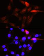 PLK1 Antibody in Immunocytochemistry (ICC/IF)