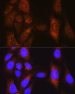 PLK1 Antibody in Immunocytochemistry (ICC/IF)