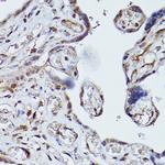 PLK1 Antibody in Immunohistochemistry (Paraffin) (IHC (P))