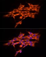 MMP14 Antibody in Immunocytochemistry (ICC/IF)