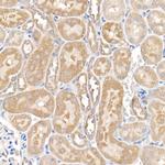 MMP14 Antibody in Immunohistochemistry (Paraffin) (IHC (P))