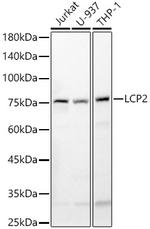 SLP76 Antibody in Western Blot (WB)