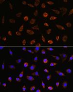 AIF Antibody in Immunocytochemistry (ICC/IF)