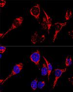 AIF Antibody in Immunocytochemistry (ICC/IF)