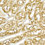 TBK1 Antibody in Immunohistochemistry (Paraffin) (IHC (P))