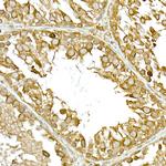 TBK1 Antibody in Immunohistochemistry (Paraffin) (IHC (P))