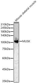MUSK Antibody in Western Blot (WB)