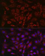 SDHA Antibody in Immunocytochemistry (ICC/IF)