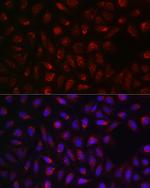 SDHA Antibody in Immunocytochemistry (ICC/IF)