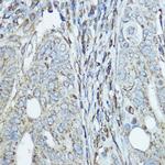 SDHA Antibody in Immunohistochemistry (Paraffin) (IHC (P))