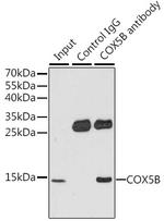 COX5B Antibody in Immunoprecipitation (IP)