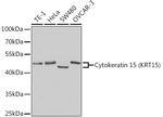 Cytokeratin 15 Antibody in Western Blot (WB)