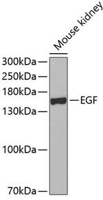 EGF Antibody in Western Blot (WB)