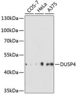 MKP2 Antibody in Western Blot (WB)