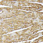 TRAP1 Antibody in Immunohistochemistry (Paraffin) (IHC (P))