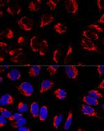 Mitofilin Antibody in Immunocytochemistry (ICC/IF)