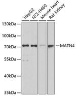 MATN4 Antibody in Western Blot (WB)