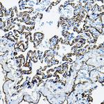 ACE Antibody in Immunohistochemistry (Paraffin) (IHC (P))