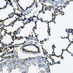 ACE Antibody in Immunohistochemistry (Paraffin) (IHC (P))