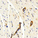 LAMP3 Antibody in Immunohistochemistry (Paraffin) (IHC (P))