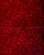 EAAC1 Antibody in Immunohistochemistry (Paraffin) (IHC (P))