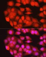 MURF1 Antibody in Immunocytochemistry (ICC/IF)