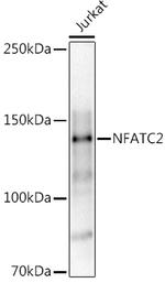 NFATC2 Antibody in Western Blot (WB)