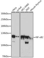 NFkB p52 Antibody in Western Blot (WB)