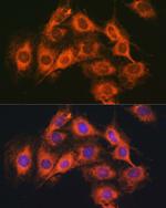 PACAP Receptor Antibody in Immunocytochemistry (ICC/IF)