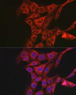 PACAP Receptor Antibody in Immunocytochemistry (ICC/IF)