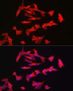 PACAP Receptor Antibody in Immunocytochemistry (ICC/IF)