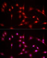 NFIA Antibody in Immunocytochemistry (ICC/IF)