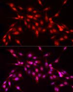 NFIA Antibody in Immunocytochemistry (ICC/IF)