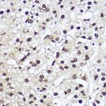 NFIA Antibody in Immunohistochemistry (Paraffin) (IHC (P))