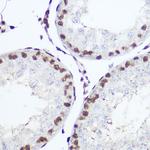 NFIA Antibody in Immunohistochemistry (Paraffin) (IHC (P))