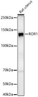 ROR1 Antibody in Western Blot (WB)