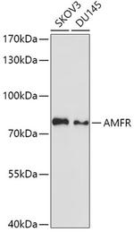 AMFR Antibody in Western Blot (WB)