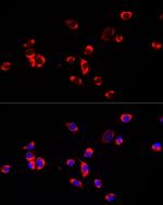 ECHS1 Antibody in Immunocytochemistry (ICC/IF)