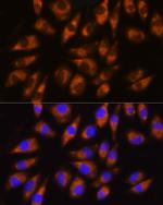 GRK5 Antibody in Immunocytochemistry (ICC/IF)