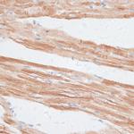 GRK5 Antibody in Immunohistochemistry (Paraffin) (IHC (P))