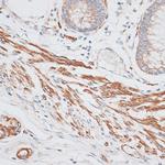 GRK5 Antibody in Immunohistochemistry (Paraffin) (IHC (P))