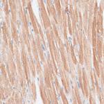 GRK5 Antibody in Immunohistochemistry (Paraffin) (IHC (P))