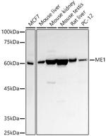 ME1 Antibody in Western Blot (WB)