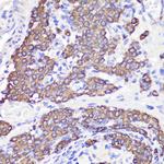 UBL3 Antibody in Immunohistochemistry (Paraffin) (IHC (P))