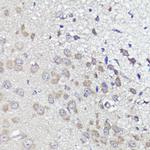 UBL3 Antibody in Immunohistochemistry (Paraffin) (IHC (P))